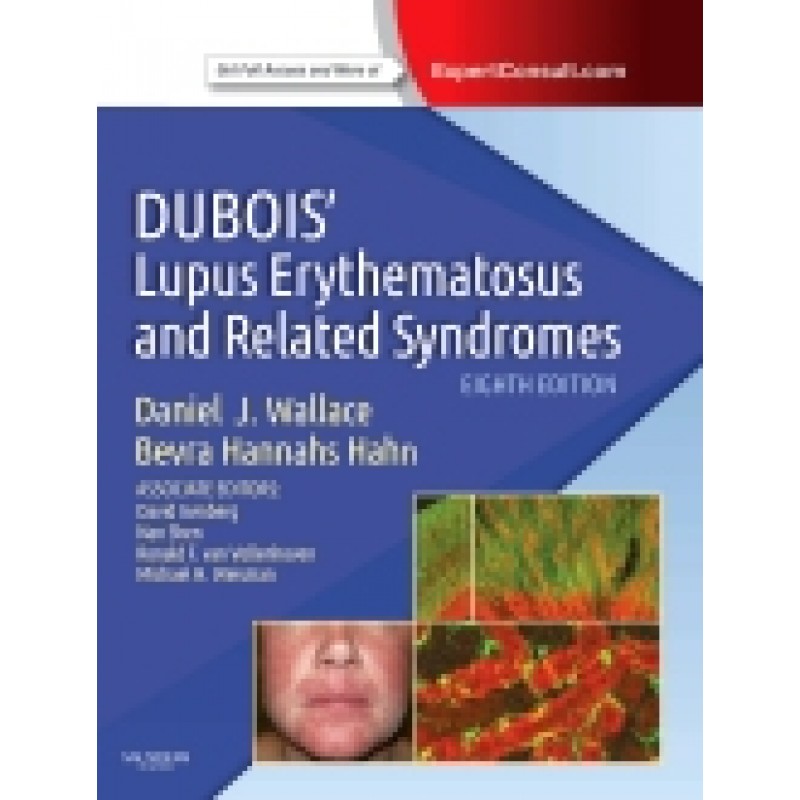 Dubois' Lupus Erythematosus and Related Syndromes, 8th Edition